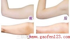 怎样瘦手臂 肉肉神马的都跑掉